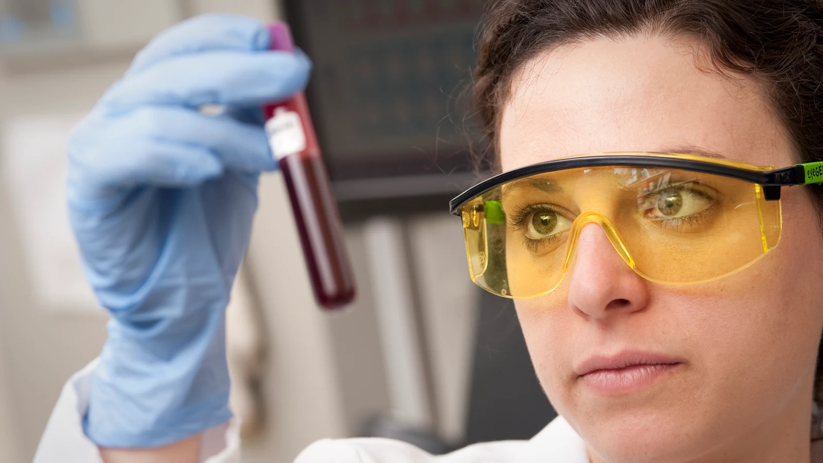 A scientist in a white laboratory coat examines a blood sample tube at a bright lab bench.